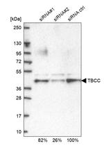 TBCC Antibody in Western Blot (WB)