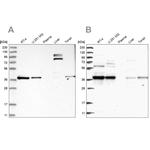 TBCC Antibody in Western Blot (WB)