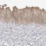 TBCC Antibody in Immunohistochemistry (IHC)