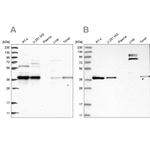 TBCC Antibody in Western Blot (WB)