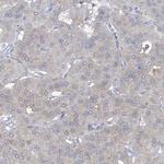 TRMT2B Antibody in Immunohistochemistry (IHC)