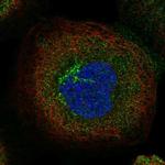 TBC1D5 Antibody in Immunocytochemistry (ICC/IF)