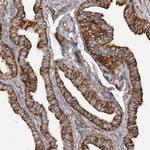 TBC1D5 Antibody in Immunohistochemistry (IHC)