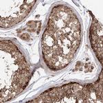 TBC1D5 Antibody in Immunohistochemistry (IHC)