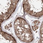 TBC1D5 Antibody in Immunohistochemistry (IHC)