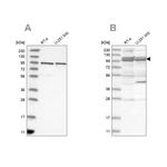 TBC1D5 Antibody in Western Blot (WB)