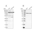 TBC1D5 Antibody in Western Blot (WB)