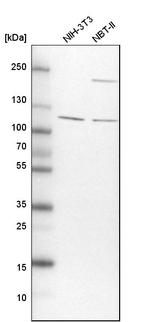 TBC1D5 Antibody in Western Blot (WB)