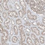 ZFAND2B Antibody in Immunohistochemistry (IHC)