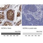 GSTM3 Antibody in Immunohistochemistry (IHC)