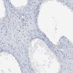 SCML1 Antibody in Immunohistochemistry (IHC)