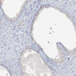 SCML1 Antibody in Immunohistochemistry (IHC)