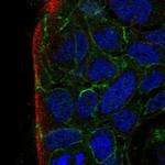 PARD3B Antibody in Immunocytochemistry (ICC/IF)