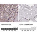 Annexin V Antibody in Immunohistochemistry (IHC)