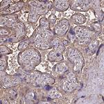 Annexin V Antibody in Immunohistochemistry (IHC)