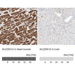 SLC25A12 Antibody in Immunohistochemistry (IHC)