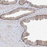 CNP Antibody in Immunohistochemistry (IHC)