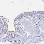 CCDC39 Antibody in Immunohistochemistry (IHC)