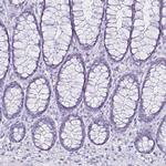 CCDC39 Antibody in Immunohistochemistry (IHC)