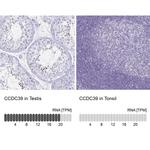 CCDC39 Antibody in Immunohistochemistry (IHC)