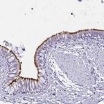 CCDC39 Antibody in Immunohistochemistry (IHC)