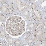 DBR1 Antibody in Immunohistochemistry (IHC)