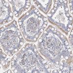 RASA2 Antibody in Immunohistochemistry (IHC)