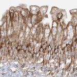 NDUFAF3 Antibody in Immunohistochemistry (IHC)