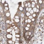 NDUFAF3 Antibody in Immunohistochemistry (IHC)