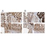 NDUFAF3 Antibody in Immunohistochemistry (IHC)