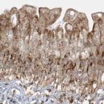 NDUFAF3 Antibody in Immunohistochemistry (IHC)