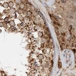 NDUFAF3 Antibody in Immunohistochemistry (IHC)