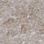 THNSL2 Antibody in Immunohistochemistry (IHC)