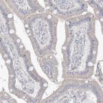 MTHFD2L Antibody in Immunohistochemistry (IHC)