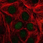 TFF3 Antibody in Immunocytochemistry (ICC/IF)