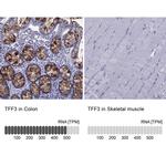 TFF3 Antibody in Immunohistochemistry (IHC)