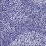 TFF3 Antibody in Immunohistochemistry (IHC)