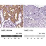 GALM Antibody in Immunohistochemistry (IHC)