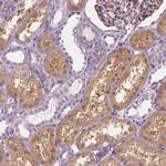 GALM Antibody in Immunohistochemistry (IHC)