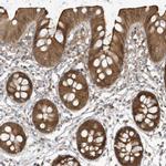 HNMT Antibody in Immunohistochemistry (IHC)