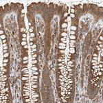 HNMT Antibody in Immunohistochemistry (IHC)