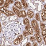 MYO6 Antibody in Immunohistochemistry (IHC)