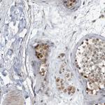 KIF15 Antibody in Immunohistochemistry (IHC)