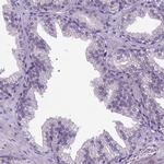 NEK5 Antibody in Immunohistochemistry (IHC)