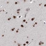 SCAF8 Antibody in Immunohistochemistry (IHC)