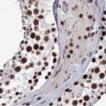 SCAF8 Antibody in Immunohistochemistry (IHC)