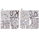 SCAF8 Antibody in Immunohistochemistry (IHC)