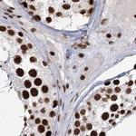 SCAF8 Antibody in Immunohistochemistry (IHC)