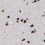 SCAF8 Antibody in Immunohistochemistry (IHC)