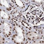 SCAF8 Antibody in Immunohistochemistry (IHC)